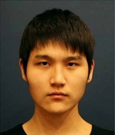 Korean_plastic_surgery_before_and_after_14