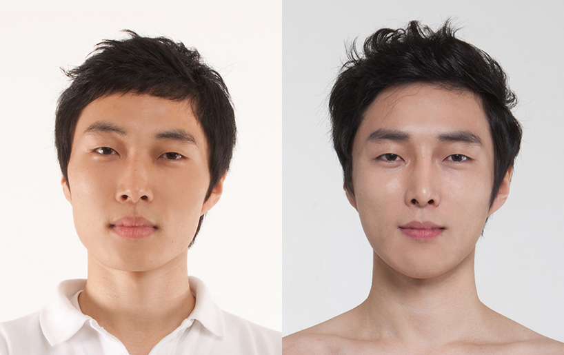 Korean_plastic_surgery_before_and_after_20