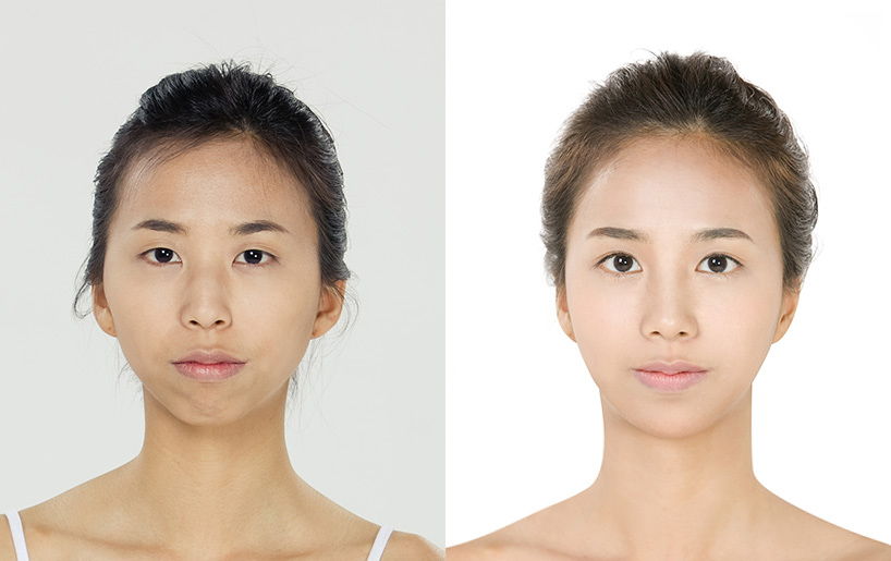 Korean_plastic_surgery_before_and_after_23. 