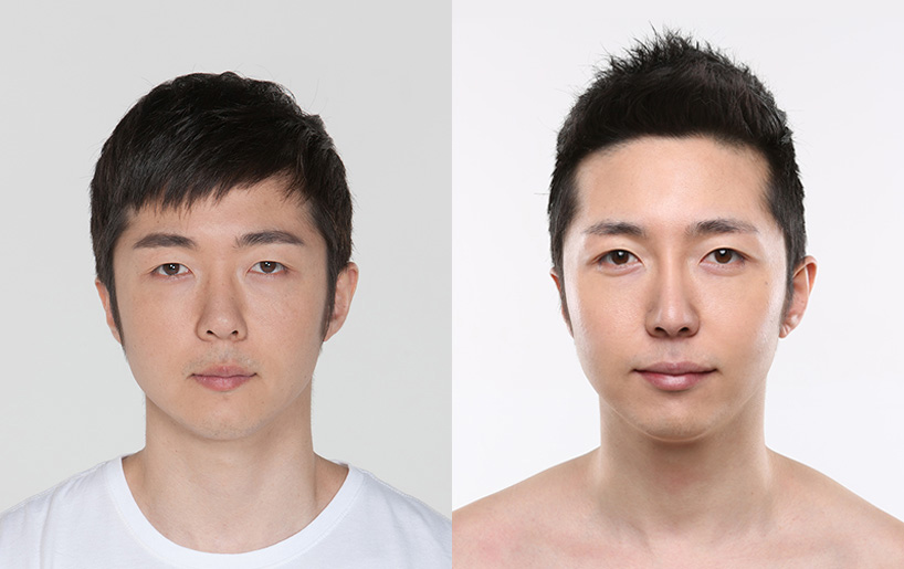 Korean_plastic_surgery_before_and_after_26