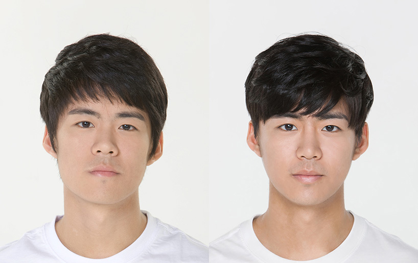 Korean_plastic_surgery_before_and_after_29