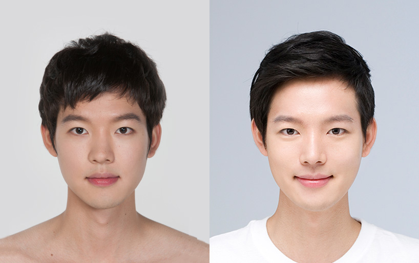 Korean_plastic_surgery_before_and_after_40