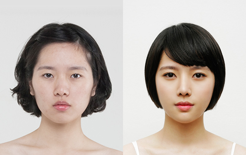 Korean_plastic_surgery_before_and_after_43.