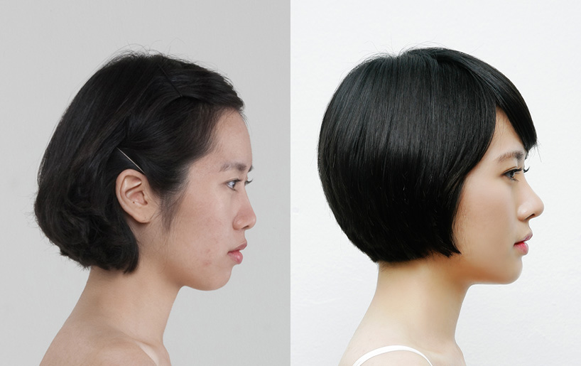 Korean_plastic_surgery_before_and_after_45