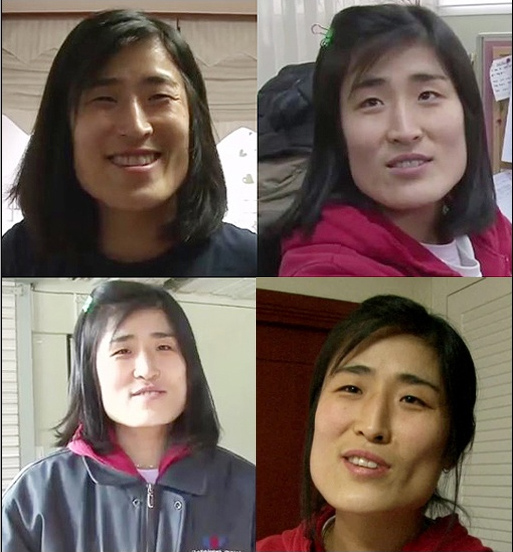 Korean_plastic_surgery_before_and_after_6