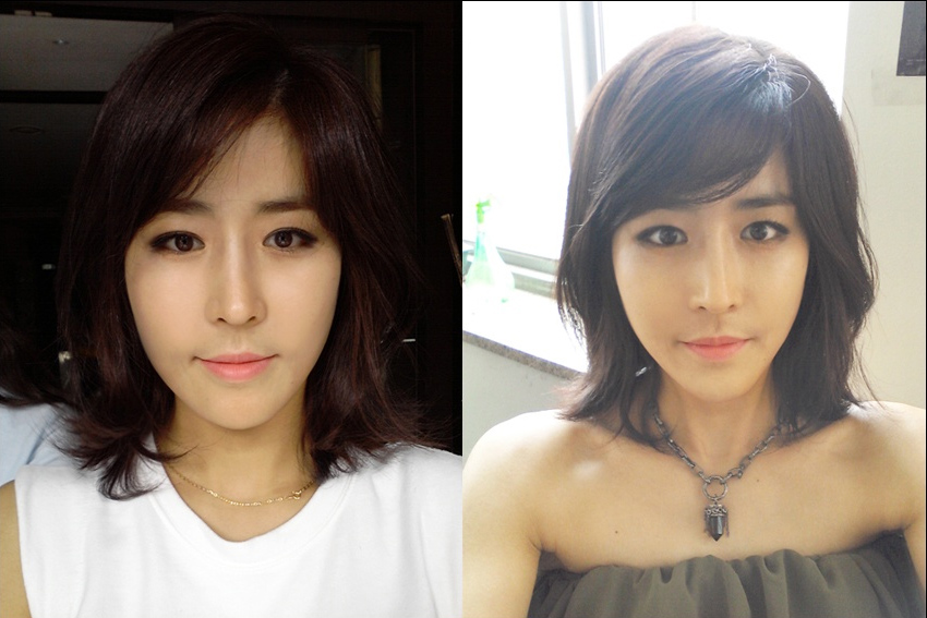 Korean_plastic_surgery_before_and_after_8