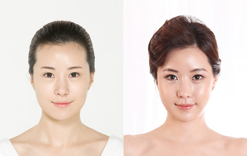 Korean_plastic_surgery_before_and_after_35