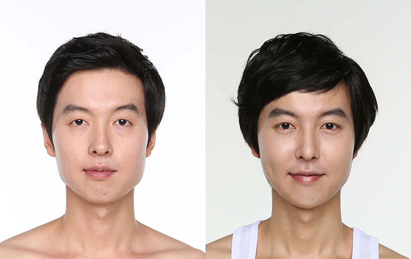 Korean_plastic_surgery_before_and_after_37