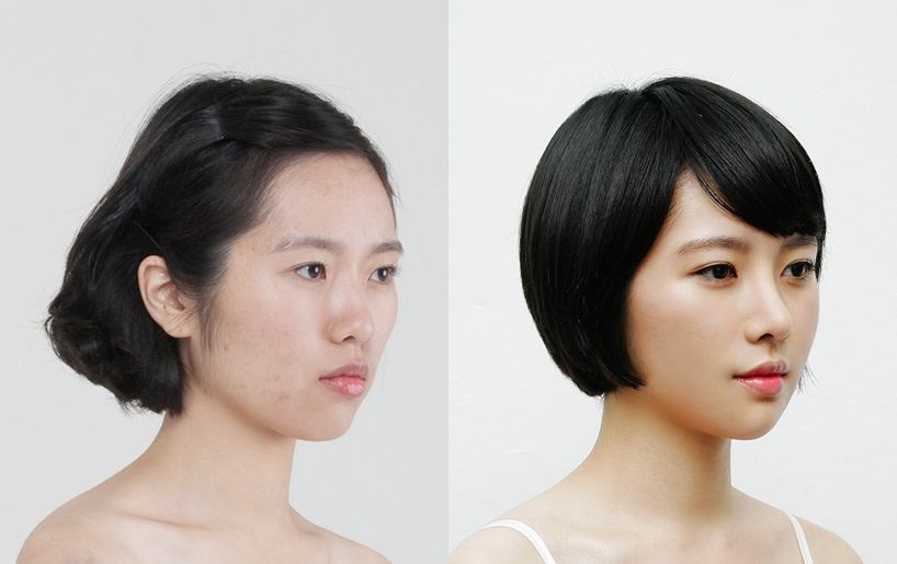 Korean_plastic_surgery_before_and_after_44